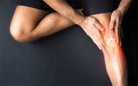 Hội chứng Felty - Hình ảnh minh họa